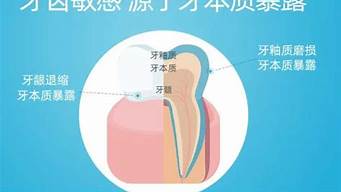 拯救牙齿敏感问题：从源头入手的解决方法